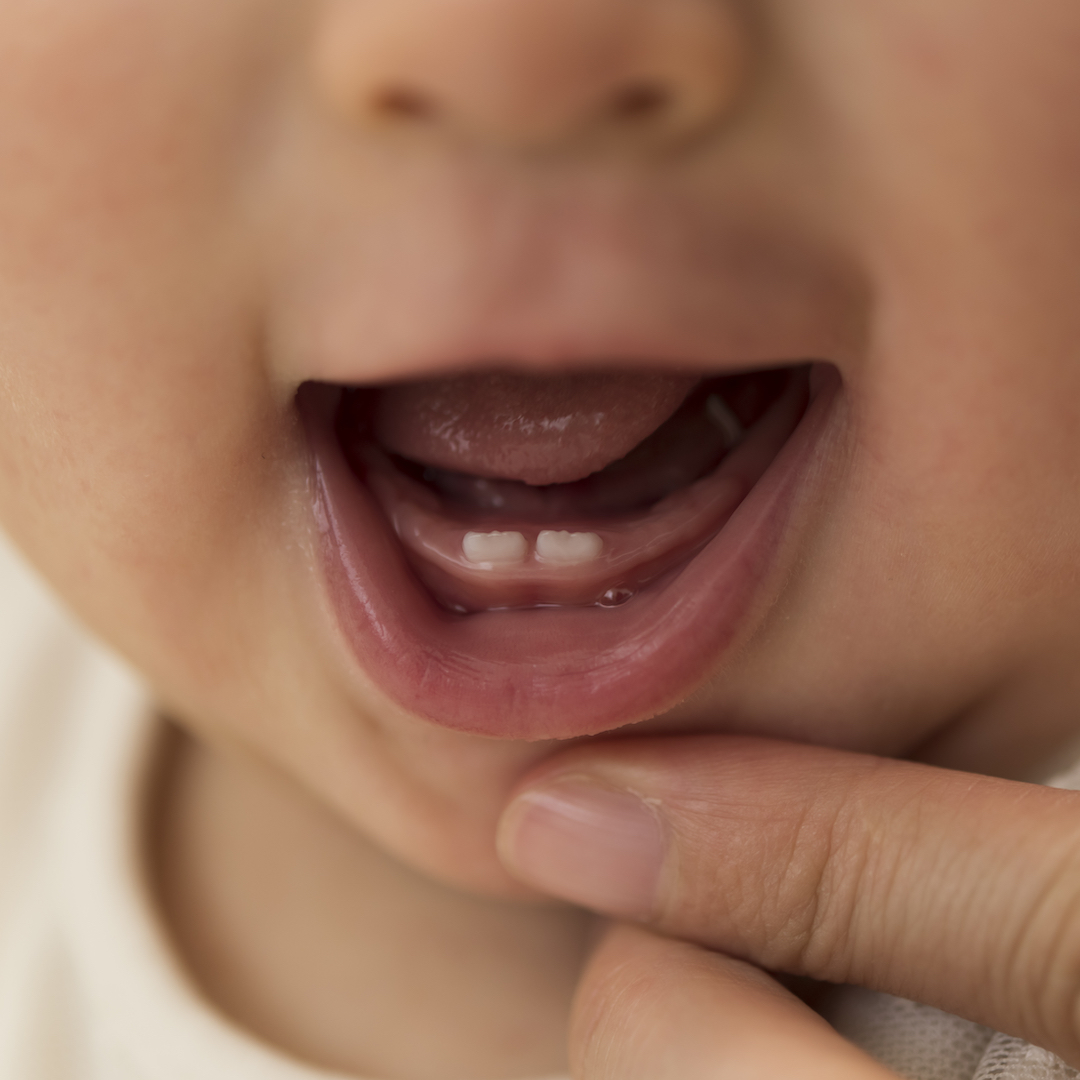 小児歯科専門医監修 歯ぐずりとは 赤ちゃんの歯の生え始めに気をつけること Mamadays ママデイズ