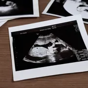 妊婦健診のエコー検査でわかる胎児の異常とは？時期別に解説