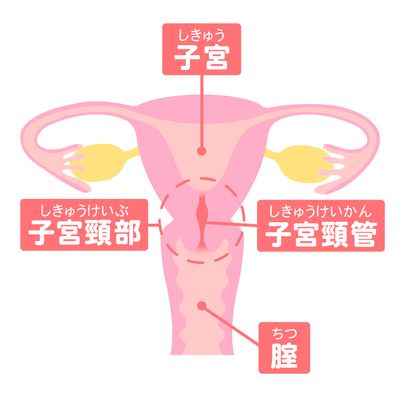 子宮頸管炎とは/図