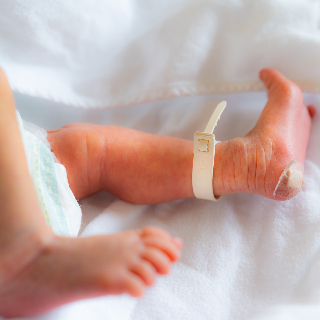 医師監修 早産で生まれた赤ちゃんの生存率は 後遺症の可能性は 2ページ目 Mamadays ママデイズ