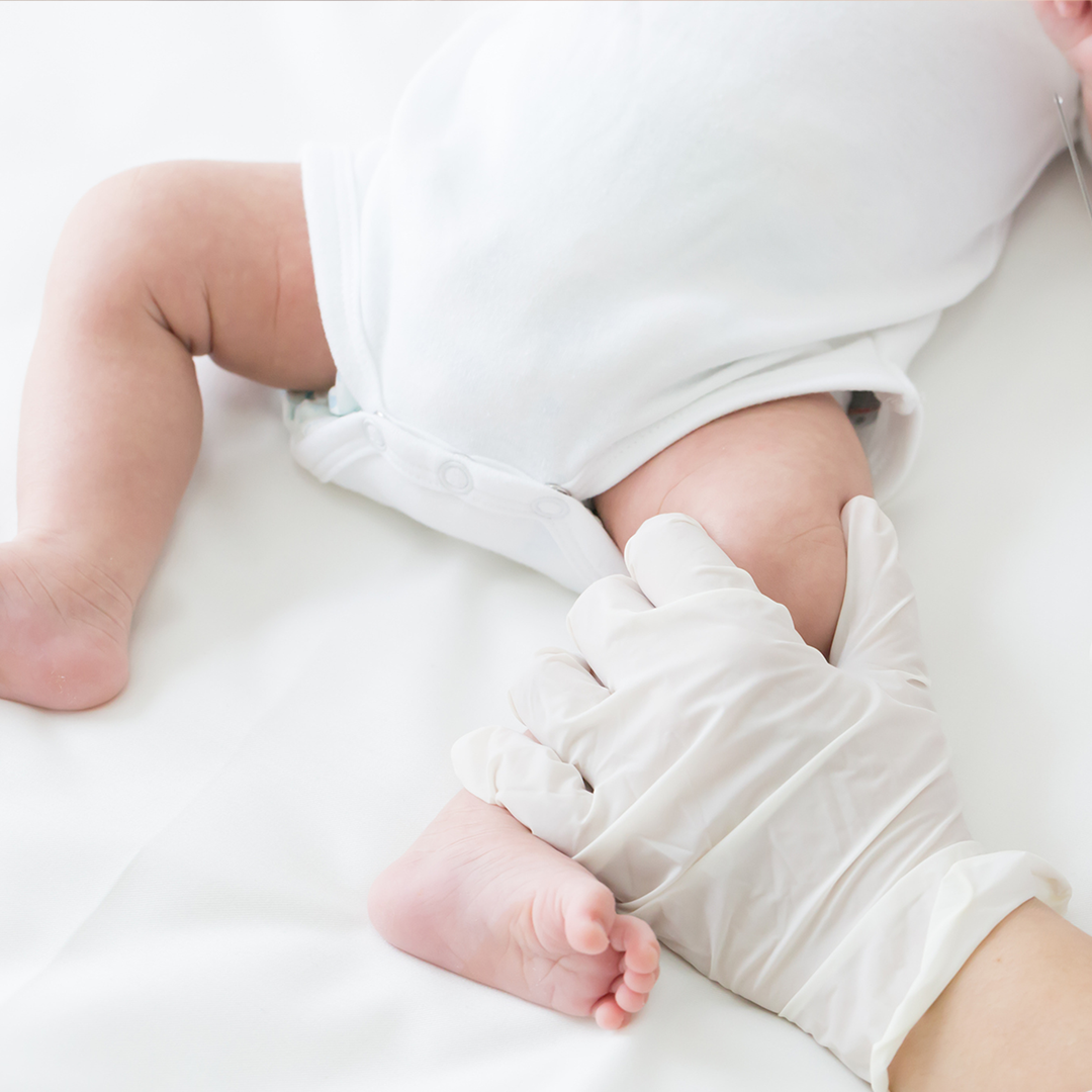 赤ちゃんの発疹が主症状の病気 風疹 Mamadays ママデイズ