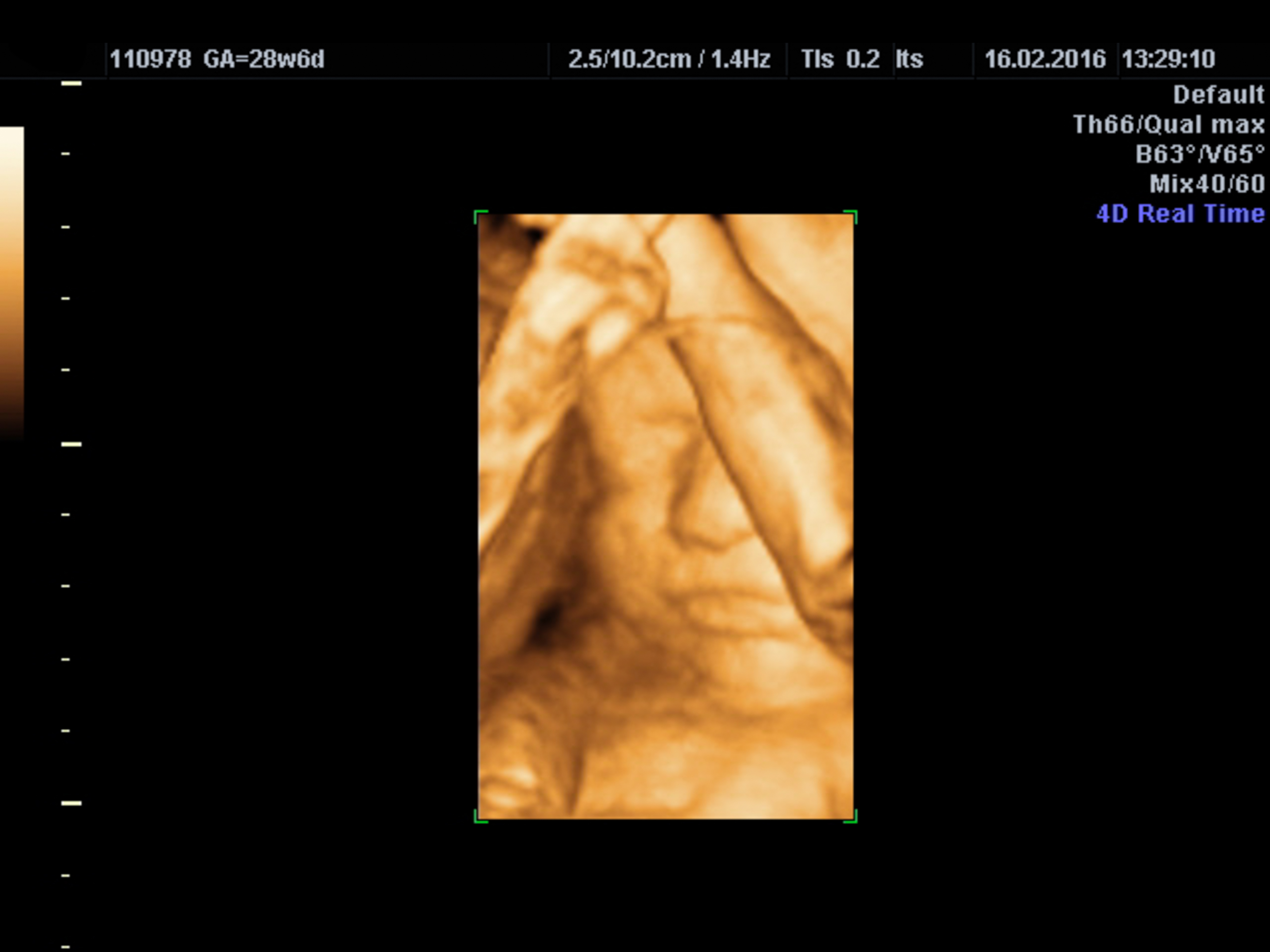 医師監修 おなかの赤ちゃんのエコー検査 4dとは 2d 3dとはどう違う Mamadays ママデイズ