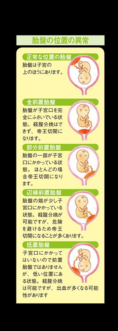 前置胎盤の場合 ヨガやウォーキングはしないほうがいい Mamadays ママデイズ