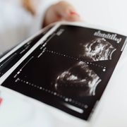 【医師監修】妊娠6ヶ月（20・21・22・23週）のママと赤ちゃんの様子