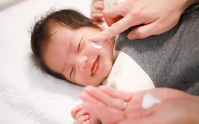 妊娠中の食事で赤ちゃんがアトピーになる？食生活と発症リスクの関係とは