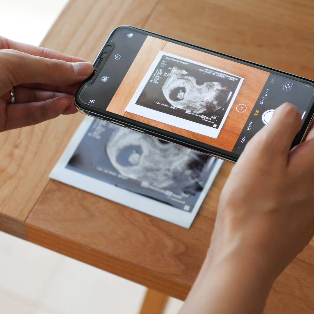 放っておくと消える エコー写真の保存術 Mamadays ママデイズ