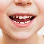 意識して防ごう　年齢で変わる虫歯になりやすい場所は？