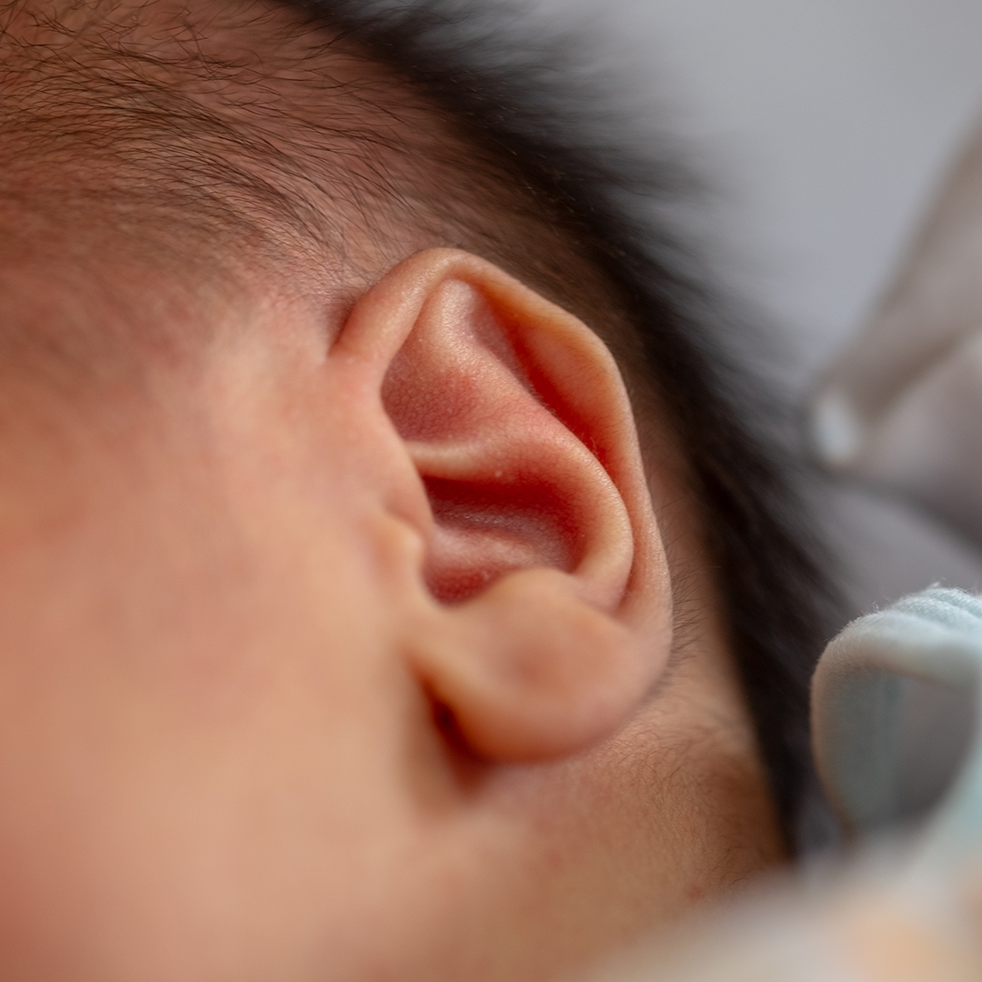 小児科医監修 赤ちゃんと子どもの症状別ホームケア 耳のトラブルのホームケア Mamadays ママデイズ