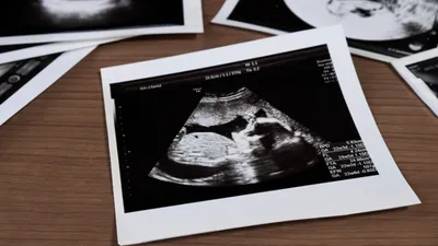 妊婦健診のエコー検査でわかる胎児の異常とは?時期別に解説