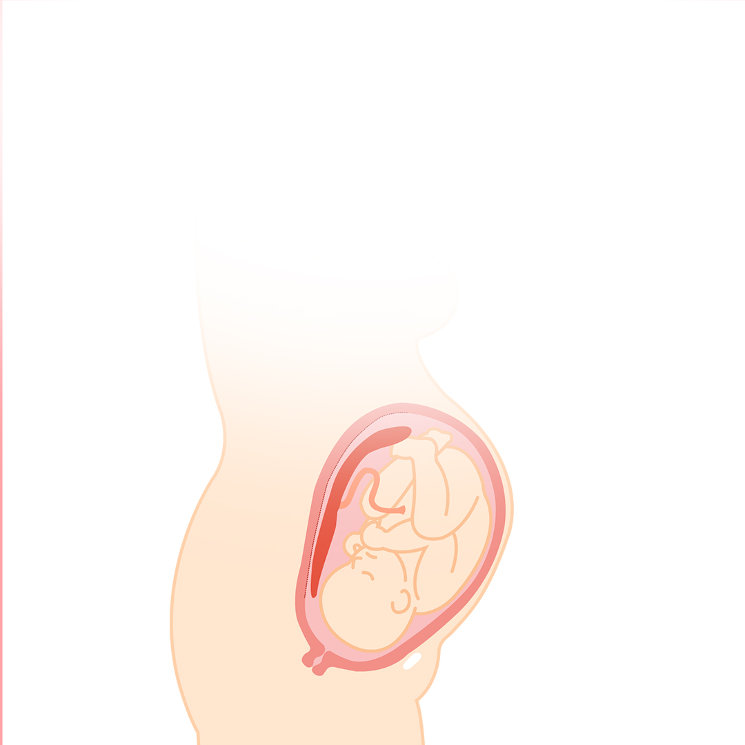 【産婦人科医監修】ごくまれでも注意が必要　胎盤のトラブル