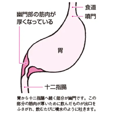 嘔吐