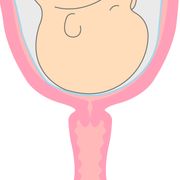 【産婦人科医監修】短いと早産に？　子宮頸管（しきゅうけいかん）の長さ