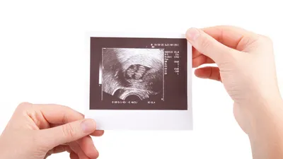 双子の妊娠で起こるバニシングツインとは?原因や赤ちゃんへの影響も解説